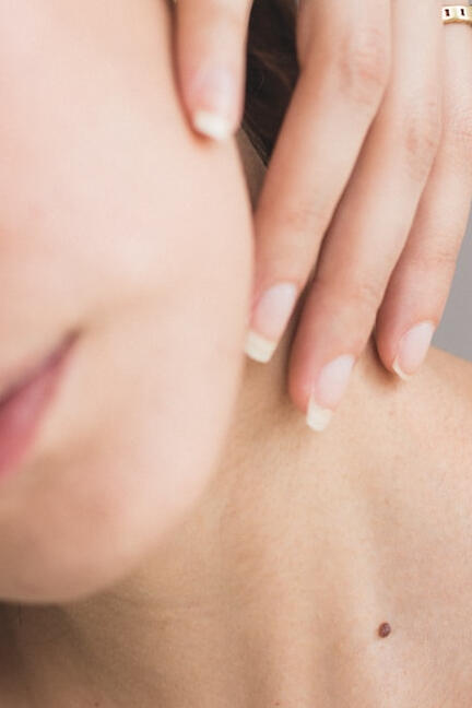 Skin Consultation